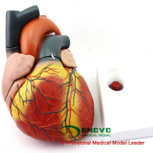 HEART11 (12487) Novo Modelo de Anatomia do Coração de tamanho grande com tamanho 4x dividido em 4 partes